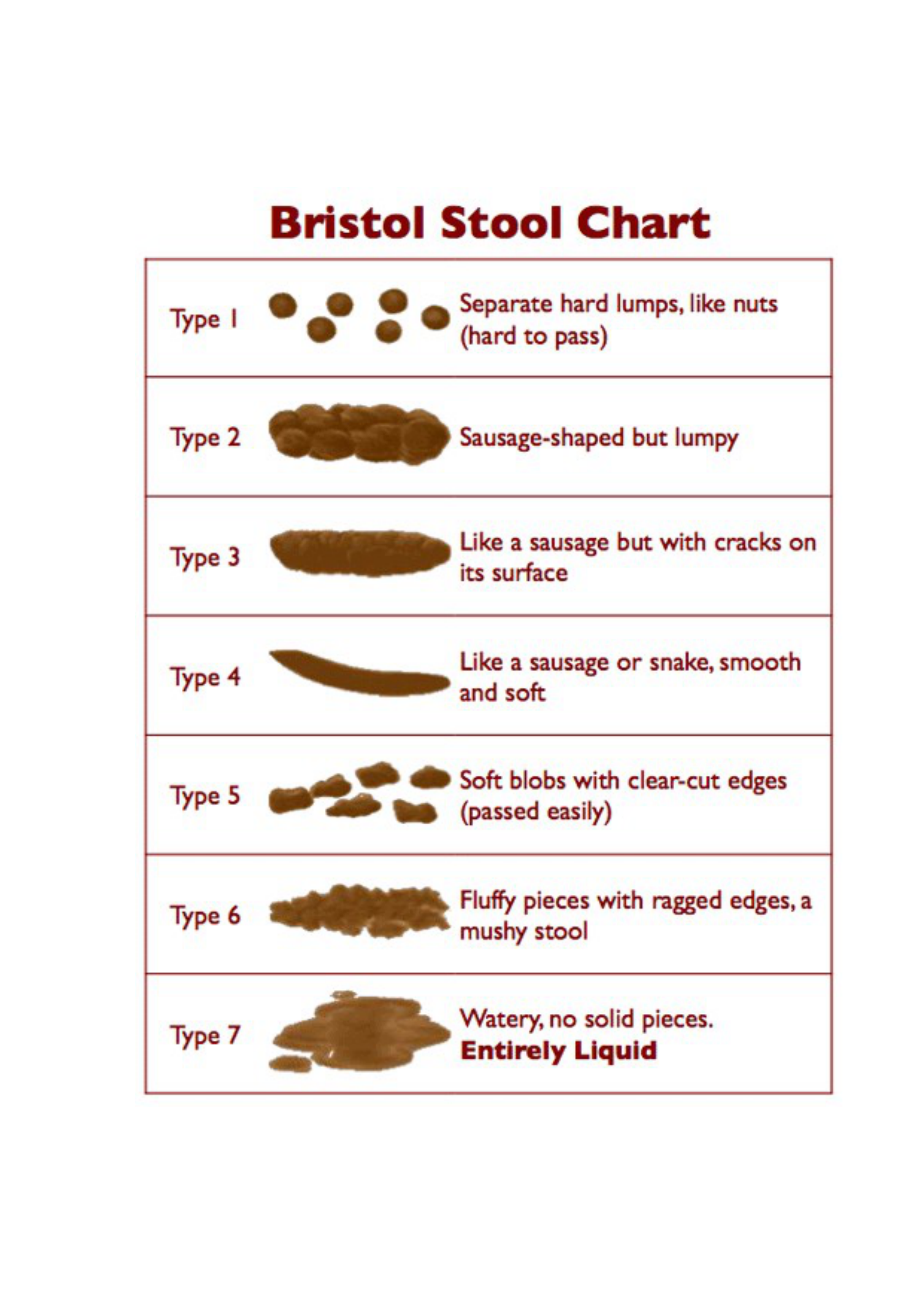 Colon Cancer Stool Color Chart